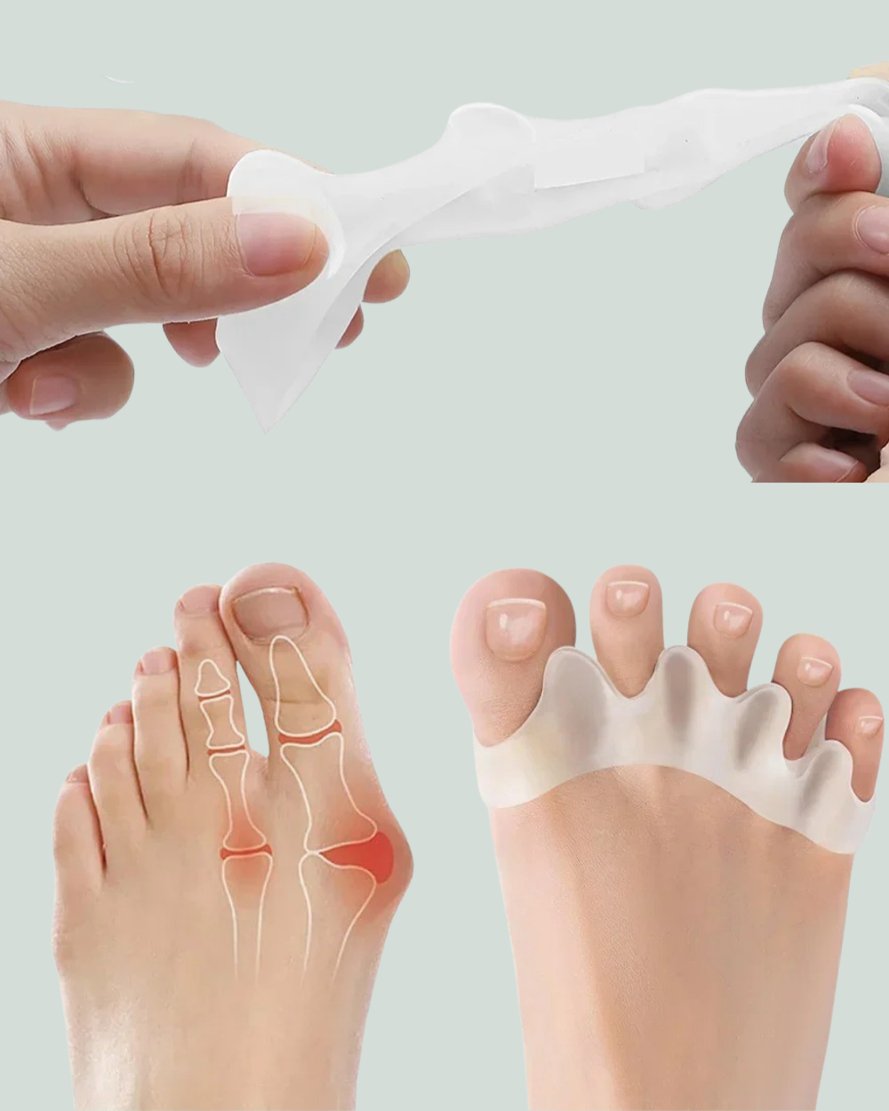 Urban Toe Separator